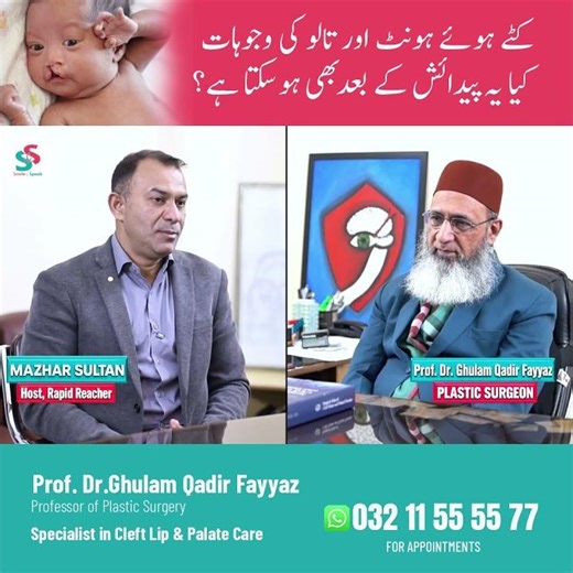 What Causes Cleft Lip & Palate? | Can it Happen After Birth? | Dr. Fayyaz