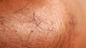Close up of Human Skin Texture