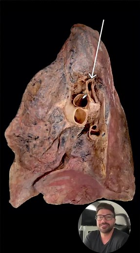 What is this structure?💯 #medschoolbootcamp #medicine #Medical #MedStudent #MedicalStudent #MedSchool #MedicalSchool #Doctor #Resident #Hospital #MD #Med #Anatomy #Science #Whitecoat #WhiteCoatCeremony #MS1 #MS2