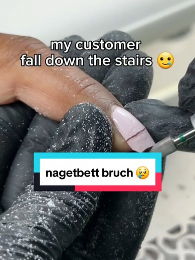Nagelreparatur nach Sturz: So geht's richtig