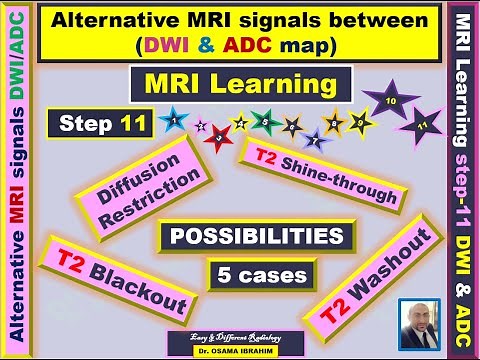 MRI learning 11; Alternative MRI signal between ADC & DWI (T2-shine through,T2 washout &T2 blackout)
