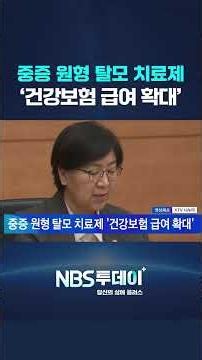중증 원형 탈모 치료제 ‘건강보험 급여 확대’