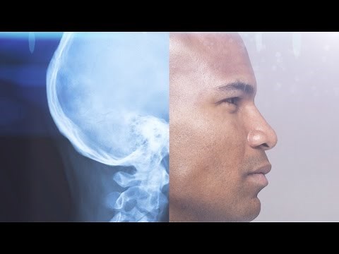 Medical Radiation Risks: 6 Facts You Need to Know | Consumer Reports