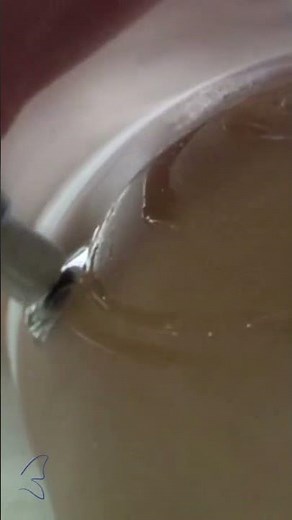 BTL X-Wave Treatment for Cellulite Reduction #shorts