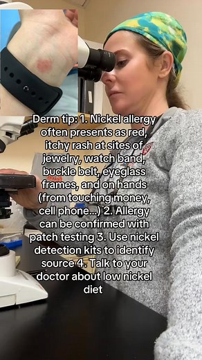 5.6K views | Nickel allergy is a common source of rash. How has nickel allergy impacted you #nickelallergy #allergic #allergicreaction #skinallergy #allergiccontactdermatitis #dermatologist | Dr. Abby Dermatologist | Facebook