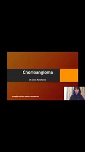 #OBGYNultrasound #placenta #chorioangioma #ultrasoundclasses #drrandhawainstitute #ultrasound #sonography | Dr.Randhawa’s Institute of Ultrasound Training ,Delhi -Affiliate Jurei,USA
