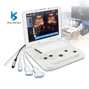 [Hot Item] K-H301 Ultrasound Machine for Human Karestar Portable Laptop Ultrasound