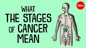 50K views · 778 reactions | When receiving a cancer diagnosis, a patient usually learns their cancer’s stage— typically a number ranging from one to four. So, what do these stages actually mean? Explore the 3 variables that inform a cancer’s stage number: | TED-Ed | Facebook