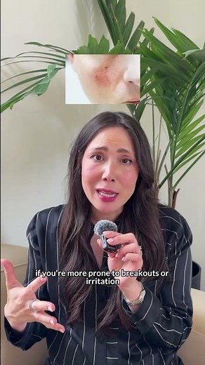 What it means to have a Damaged Skin Barrier (and what to do!!)