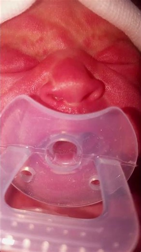 hypoglycemia #lifeisbutadream #newbornhealth #ihavethisthingwithplants #newbornbaby