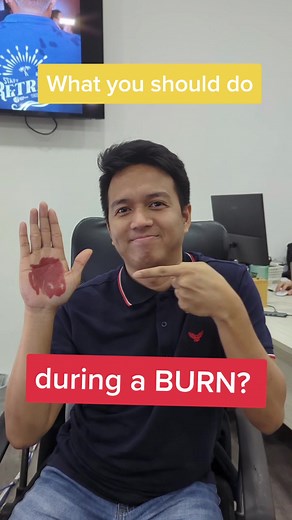 Burn Management: Tips for Treating Hand Burns