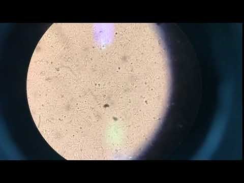 Spirochetes in dog feces