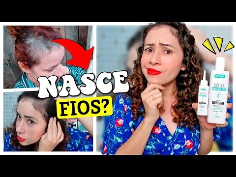 BIOPLEX NASCE FIOS REALMENTE FAZ O CABELO CRESCER E *CONTROLA A QUEDA DE CABELO*? | RESENHA