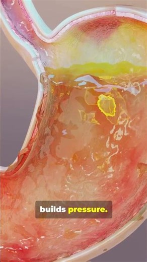 Why Soda Makes You Burp 🥤💨 #shorts