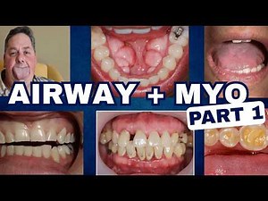 Implementing Sleep, Airway and Myo to Restorative Dentistry Part 1 - PDP262
