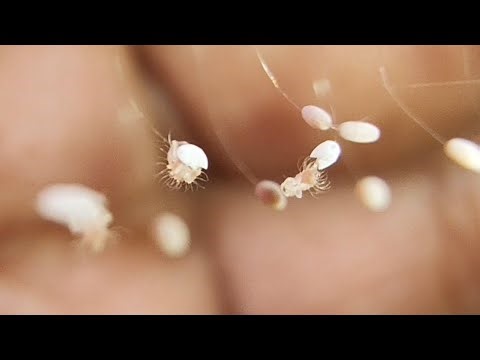 Green lacewing eggs and hatchlings 😍