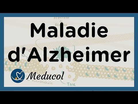 Alzheimer's - Alzheimer's Disease: Definition, Symptoms, Causes, Stages, and Treatment