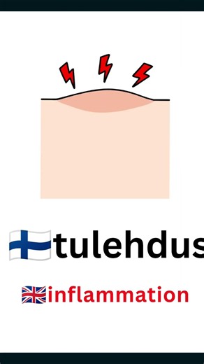oireet osa 2, symptoms part 2. let's learn new words in Finnish with clear pictures and voice, 🇫🇮🇬🇧