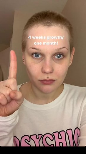 Hair Growth After a Buzz Cut: Timelines for Regrowth Explained