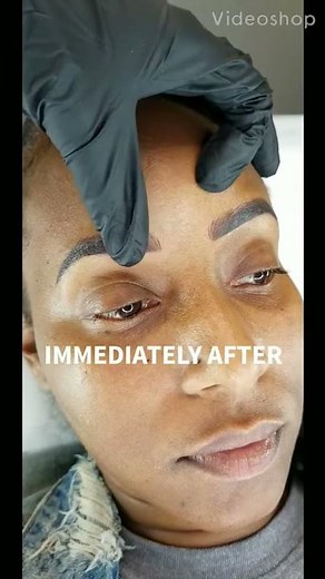 Microblading Healing