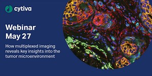 How multiplexed imaging reveals key insights into the tumor microenvironment to inform treatment and improve outcomes
