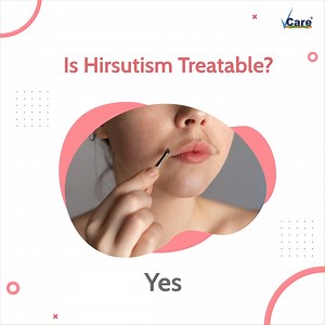 31 reactions | Hirsutism is treatable! Yes, you heard that right! Putting an end to endless shaving and waxing procedures is now possible with our advanced cool laser hair removal. Laser hair removal is a safe and effective way to slow down unwanted hair growth in all body parts, and eventually stop it forever. For consultations/appointments, contact us at +91 9500002401. #vcare #Vcareclinics #skincare #hirsutism #laserhairremovaltreatment | VCare | Facebook