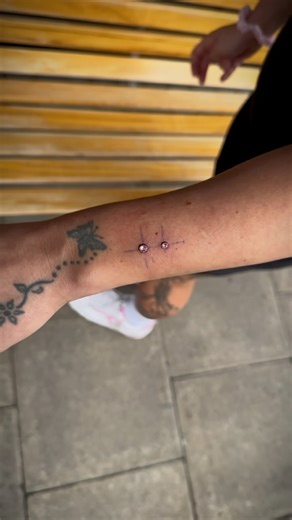 💎 2 Wrist Dermals 💎 Done by @pinsandneedless_ BOOK NOW! Link in bio! @undergroundtattoos Walk-ins available Cash only ⠀ #dermalpiercing #wristdermal #bodypiercing #piercing #piercingideas #tattooideas #londontattoo #londontattoostudio #watfordtattoo #watford #londonpiercer #londonpiercing #piercinginspiration #dermal | Underground Tattoos Watford