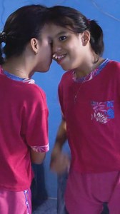 INCREDIBLE, RARE CONJOINED TWINS ❤️ #reels #viral #borndifferent #truly #conjoinedtwins #twins #conjoined #rarecondition #rare | Born Different