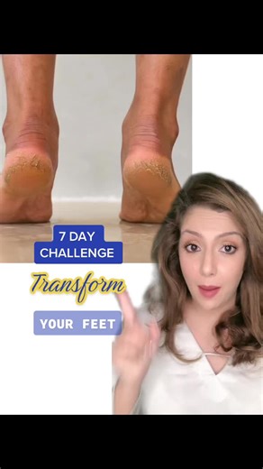 7-Day Feet Transformation Challenge for Body Care