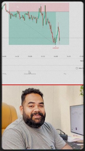 Live trading in gold using candlesticks phycology #stockmarket #trading #livetrading #goldtrader