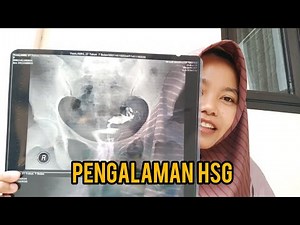 PENGALAMAN HSG UNTUK PROGRAM HAMIL DAN LANGSUNG HAMIL