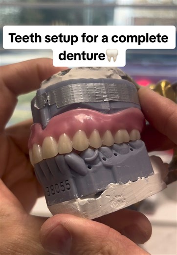Teeth setup for a complete denture✅ #teethsetup #completedenture #dentaltechnician #dentallab #dentalprosthetics