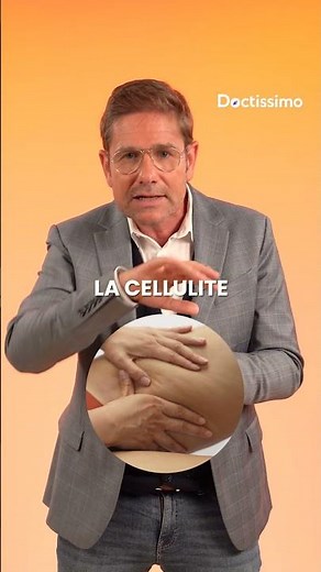 Lipedema or cellulite: how to tell the difference?