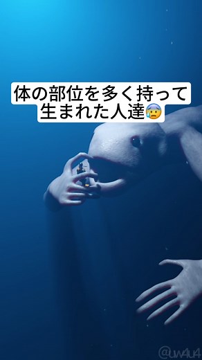 体の部位を多く持って生まれた人々