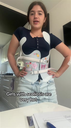 Scoliosis: Embracing Beauty in Braces