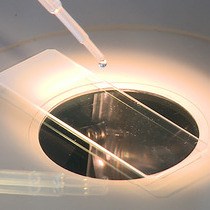 Video: Studying Diabetes Through the Eyes of a Fish: Microdissection, Visualization, and Analysis of the Adult tgfli:EGFP Zebrafish Retinal Vasculature