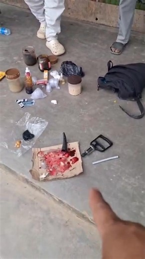 ALERT!! NEVER BELIEVE THIS KIND OF TREATMENT FROM UNQUALIFIED AND INEXPERIENCED STREET ROAMERS WHO CLAIMED TO HAVE USED UNSCRUPULOUS WAY TO REMOVING BOILS BY CHARGING HUGE AMOUNTS OF MONEY FROM INNOCENT PEOPLE OF ARUNACHAL PRADESH. THERE ARE PLENTY OF SUCH PEOPLE ESPECIALLY FROM ASSAM ROAMING OR SITTING IN THE OPEN ROADS,BUSY PUBLIC PLACES LURING OUR INNOCENT PEOPLE WHICH NEEDS TO BE ALERTED BY OUT OUR PEOPLE BY NOT FELL TO THEIR GRIEVES ANYMORE. THIS IS A NAKED TRUTH AS SHOWN IN THIS VIDEO CLIP