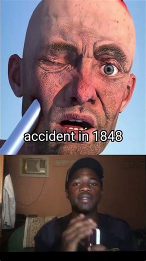 Survival with half brain😧