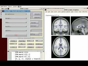 Parameter Extraction with MarsBar