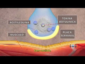 Toxina Botulínica