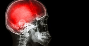 How close are we to Mapping the Human Brain?