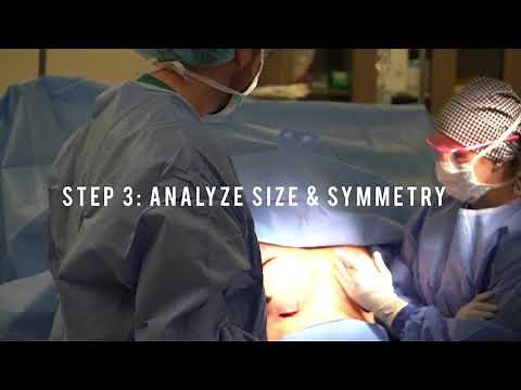 Step-By-Step Guide Through a Breast Augmentation Procedure