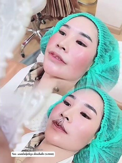 ทรงปากใหม่ คมชัดกว่าเดิม✨