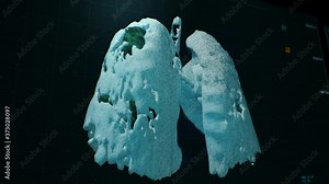 Black computer user interface of modern medical tomography scanning lungs affected by pneumonia caused by coronavirus. The actual process of creating a 3D lung model. Close-up