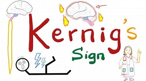 Kernig's Sign | Neurology 🧠 | Physical Exam | Meningitis/ Subarachnoid Hemorrhage 🩸 | Medicosis Perfectionalis