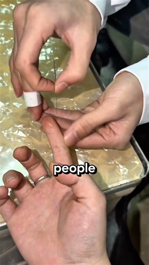 Needle Trick That Freaks Patients Out
