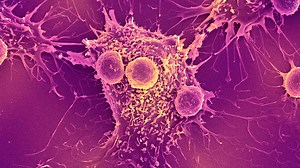 Miracles in a test tube won't cure cancer, but using and adapting the technology we already have will. This week on our Babbage podcast we discuss the best way for cancer treatments to develop in the future | The Economist