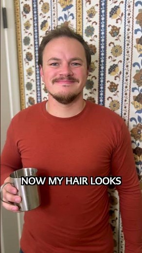 5 Month Hair Growth Results With Locklab - Healthcare Worker's Review