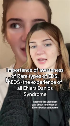 I hope I conveyed this clearly! Again in no way saying what we deal with as those with hEDS or HSD isn’t important to bring awareness to, just want to make sure we have respect and understanding for those with very rare types of Ehlers Danlos syndrome as many require MUCH urgency. “The current classification includes 13 types of Ehlers-Danlos syndrome. Each type has its own genetic causes. This results in a unique set of features for each type of EDS. Hypermobile EDS (hEDS) » Approximate Prevale