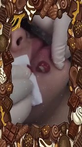 76K views · 542 reactions | Perfect Skill !! 懶 | Pimple Popping Videos | Facebook